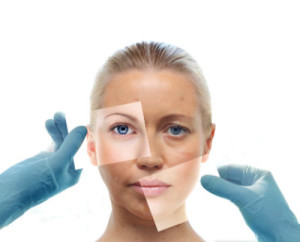 Skin Rejuvenation Gallery