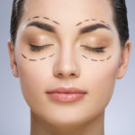 Eyelid Surgery Plantation, FL